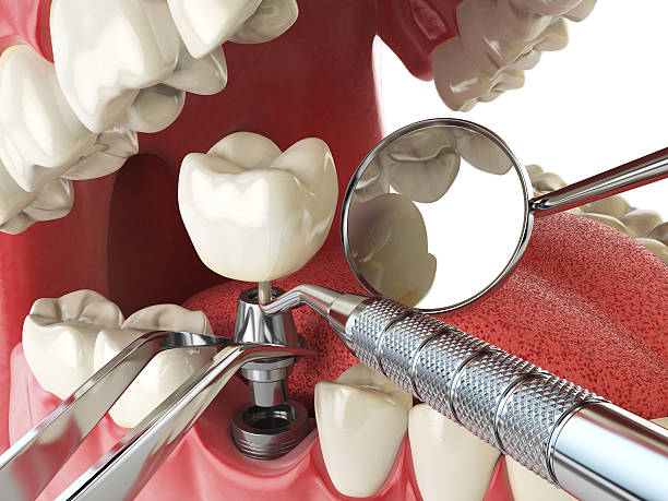 Best Broken or Cracked Tooth Emergency Dentist in Glen Dale, WV
